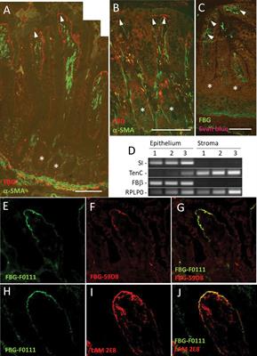 Fibrin(ogen) Is Constitutively Expressed by Differentiated Intestinal Epithelial Cells and Mediates Wound Healing